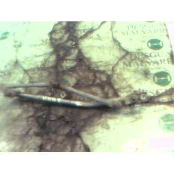 ARTICULACION LIMPIA DELANTERO 